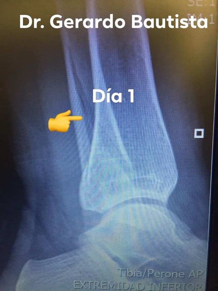 Gerardo Bautista Díaz-0