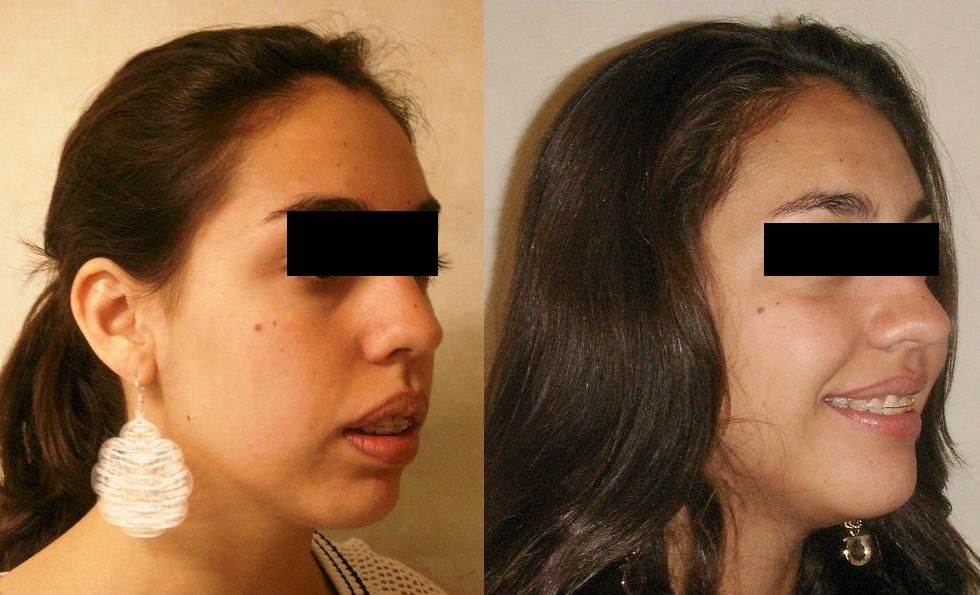 Gastón Porte Hinojosa-0