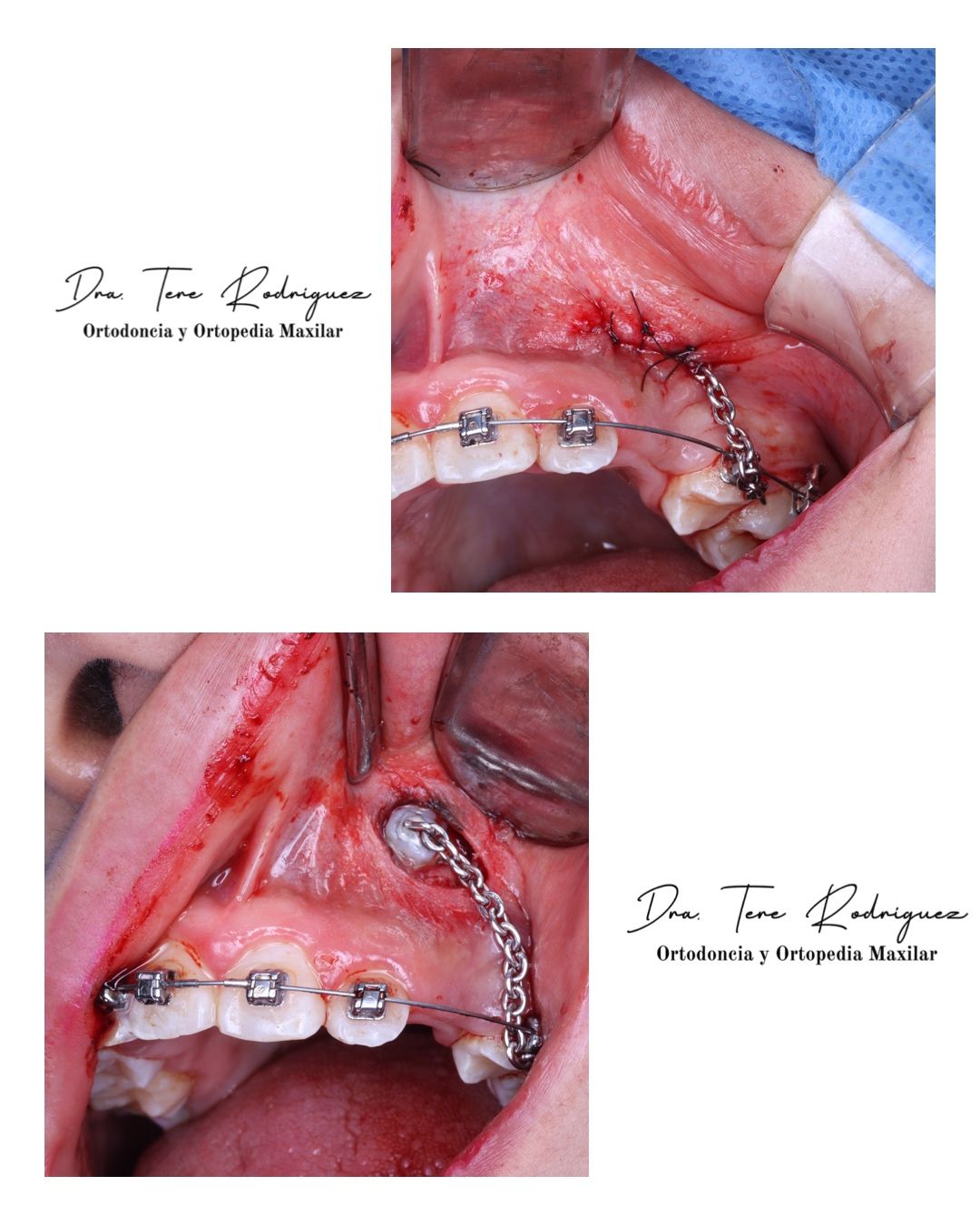 Teresa Rodriguez Candia-3