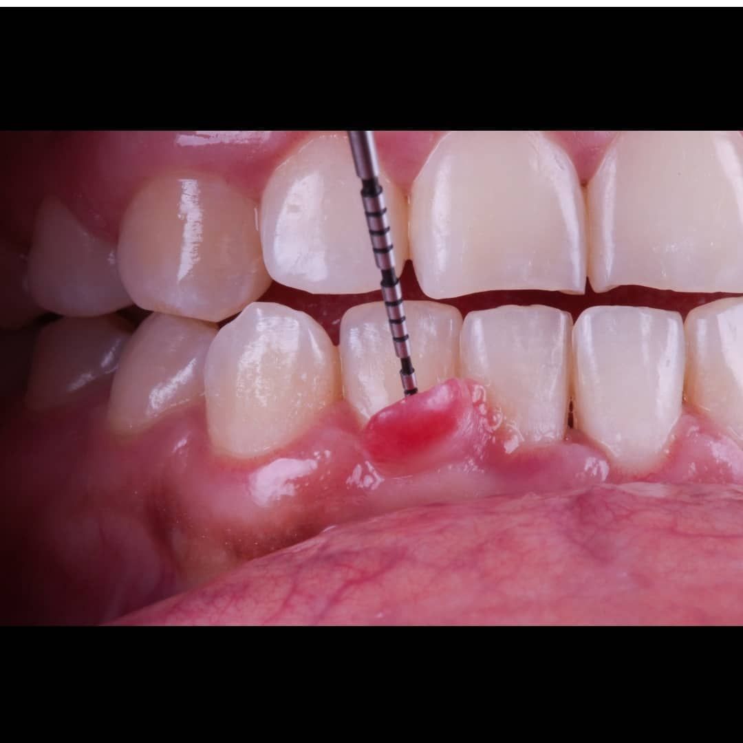 Hugo Enrique Aguilar Lamas-107