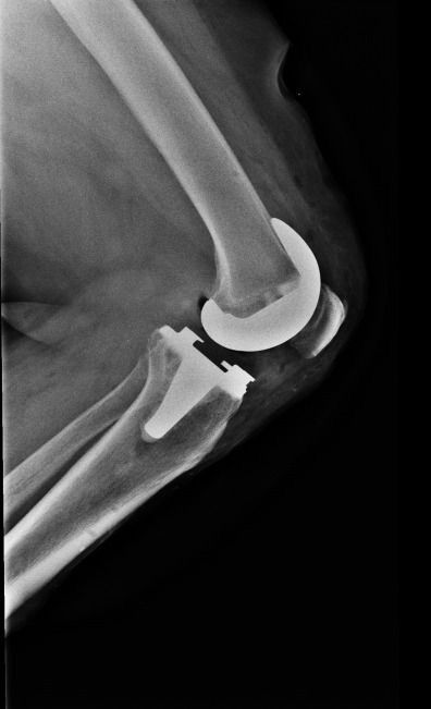 Alejandra Fuentes Martínez-13