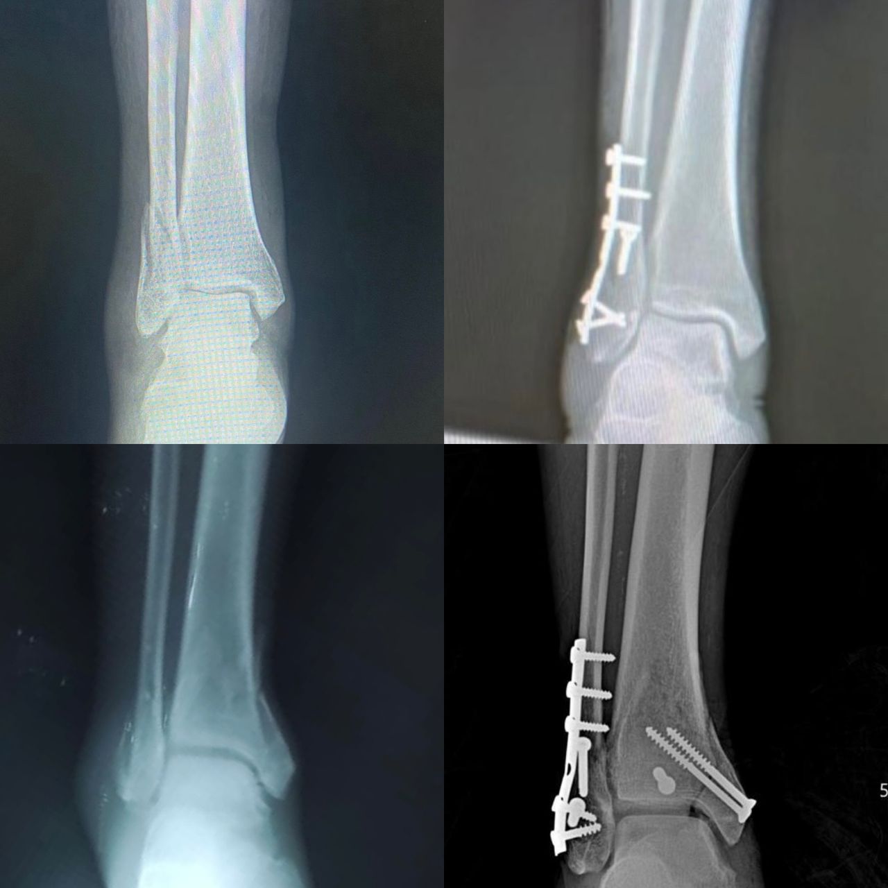 Luis Alberto Monge Bravo-7