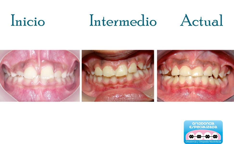 Mireya Quiroga Zamora-1