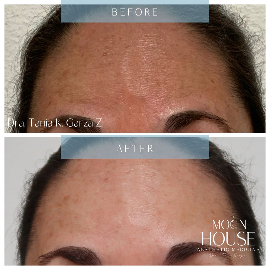 Tania Karine Garza Zepeda-2