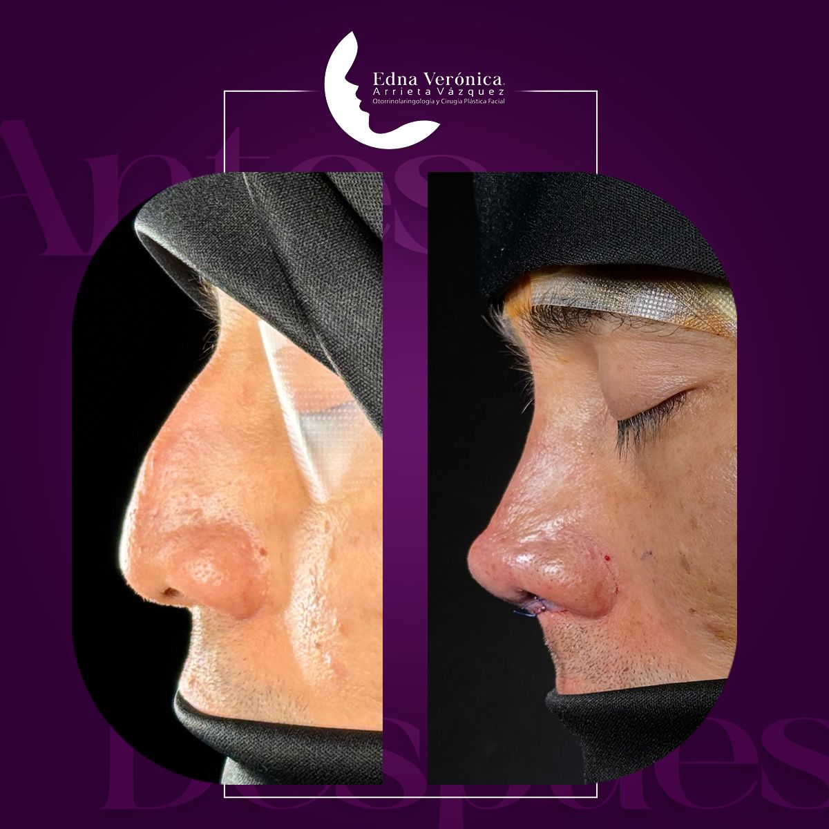 Edna Verónica Arrieta Vázquez-5