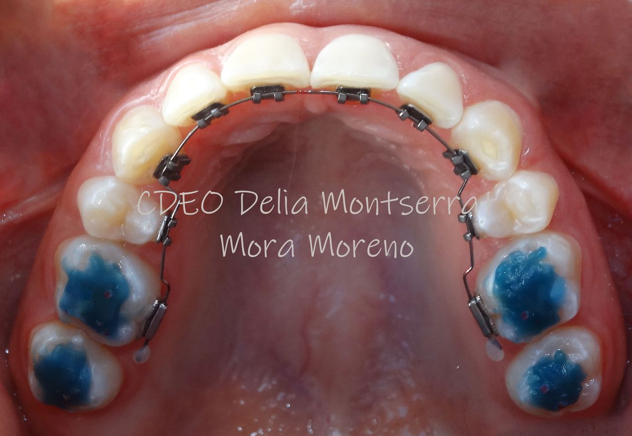 Delia Montserrat Mora Moreno-1