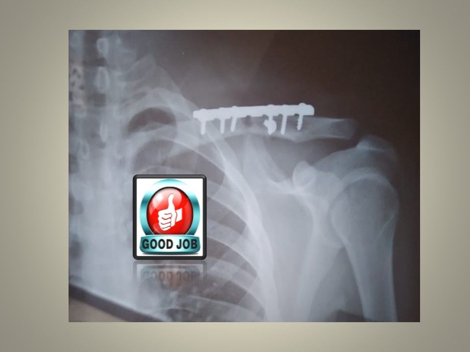 Jeftte Aaron Chacon Martinez-5