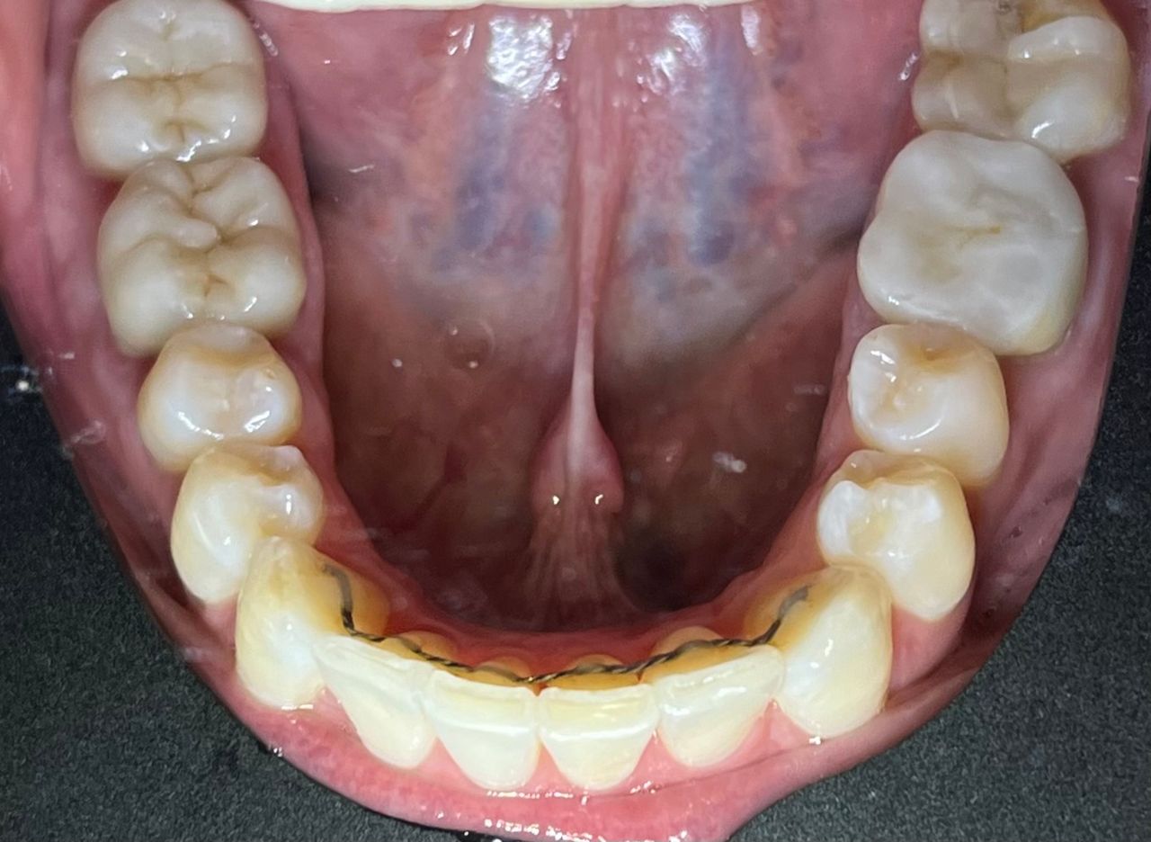 Adriana Ascanio Inciarte-1