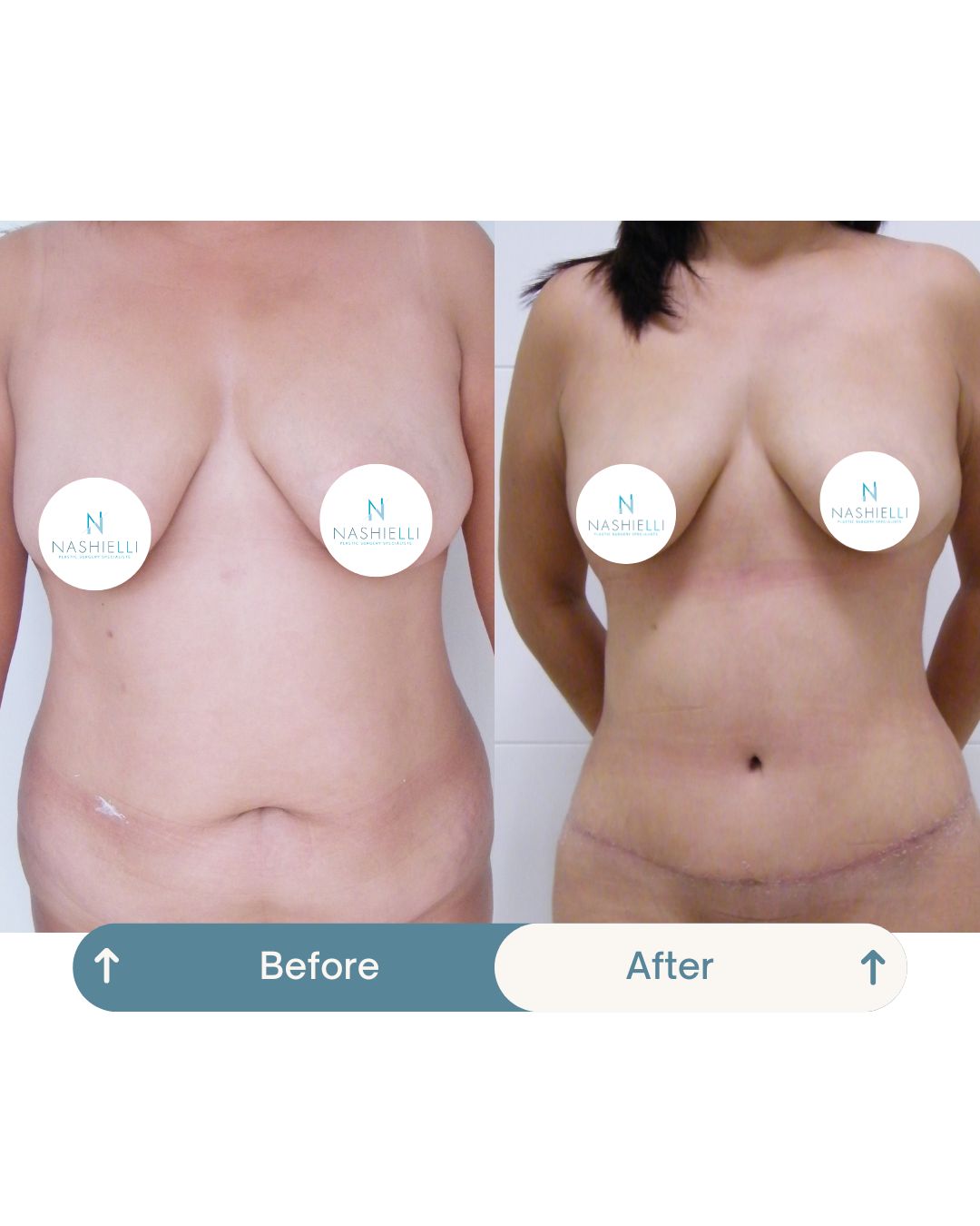 Nashielli Torres Espinosa Chiu-13