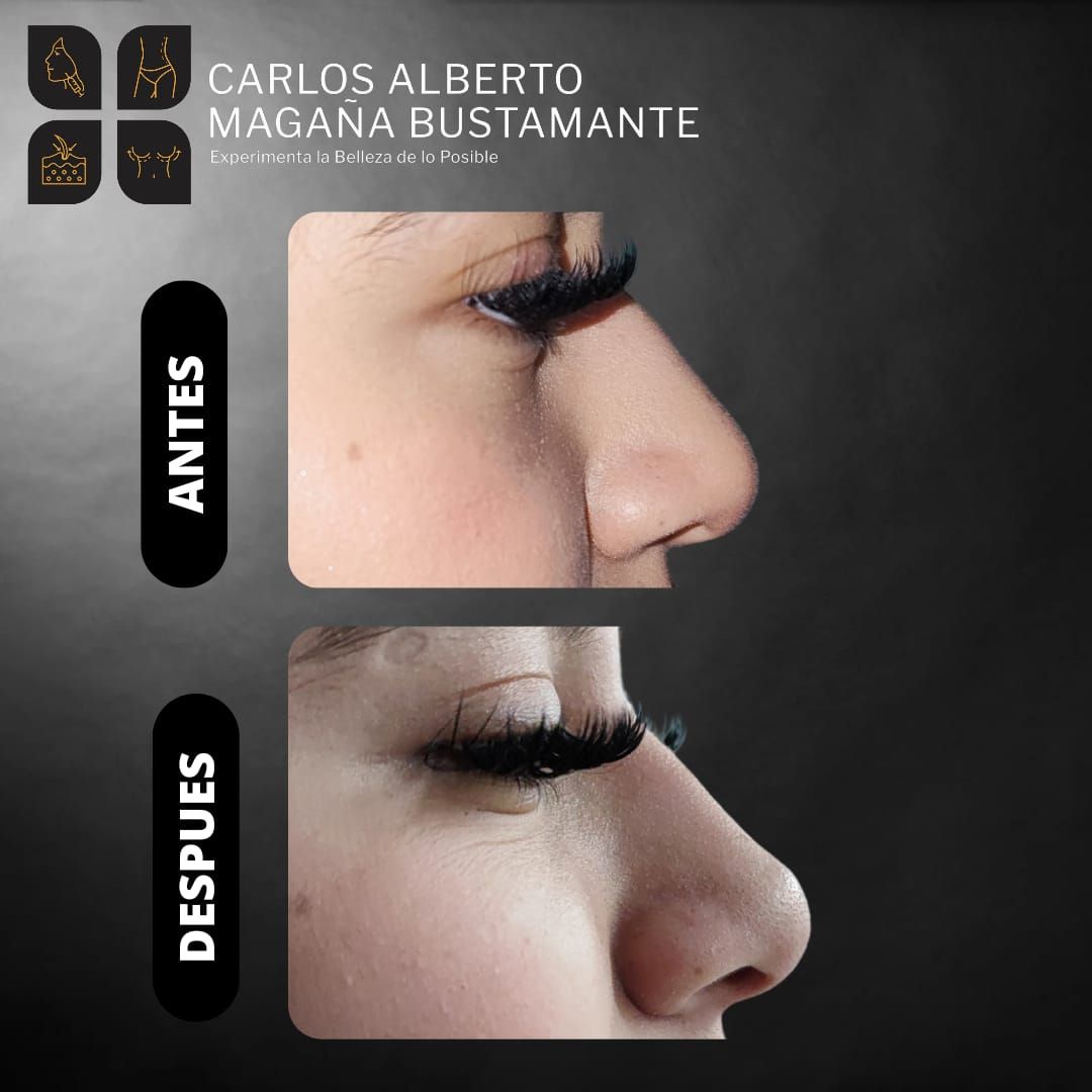 Carlos Alberto Magaña Bustamante-19