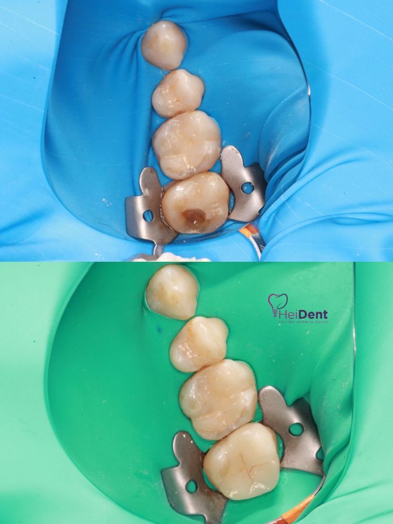 Heidi Mendoza Malagón-23