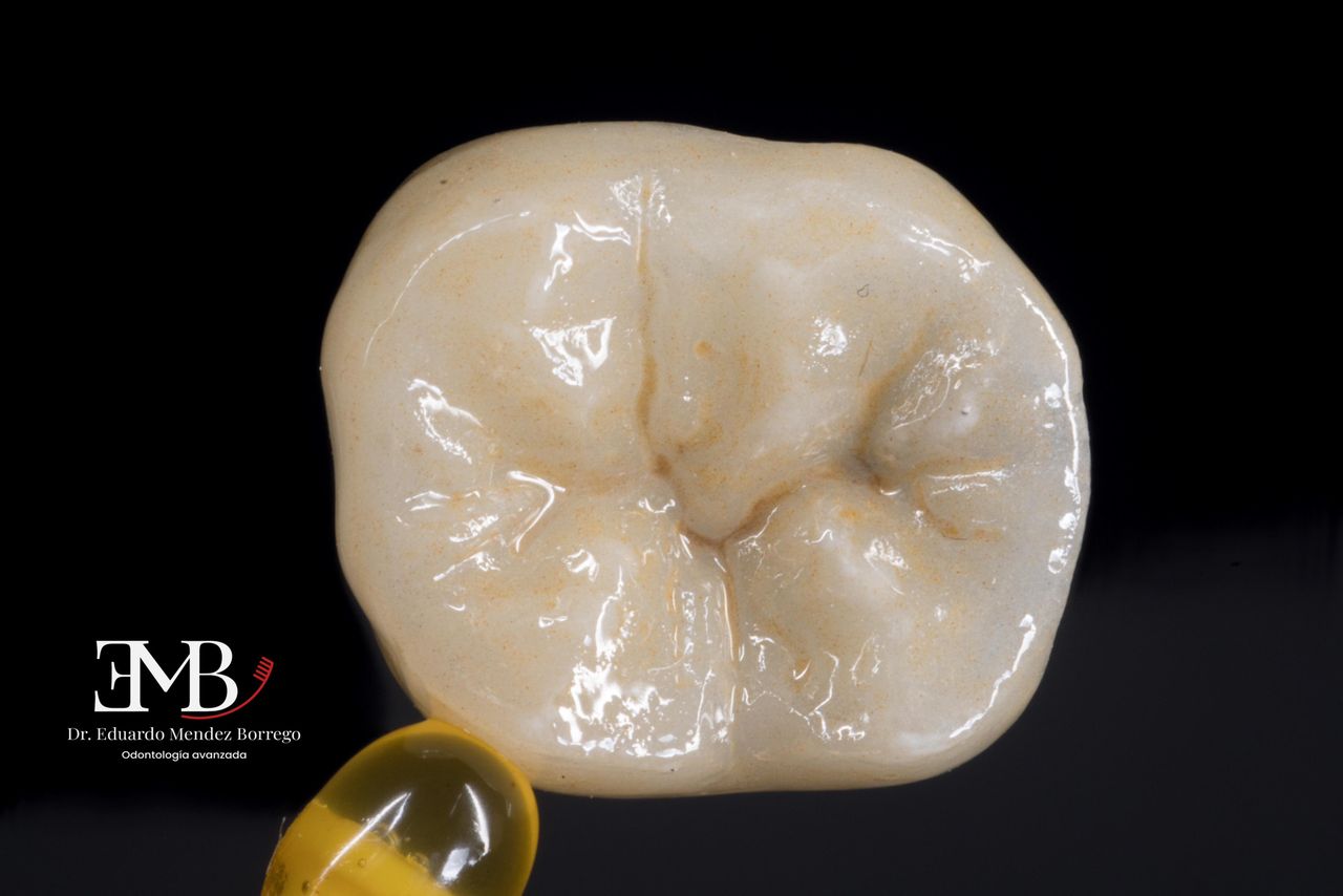 Hervin Eduardo Mendez Borrego-24