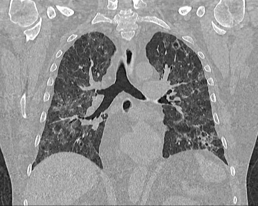 Miguel Franco Estrada-6