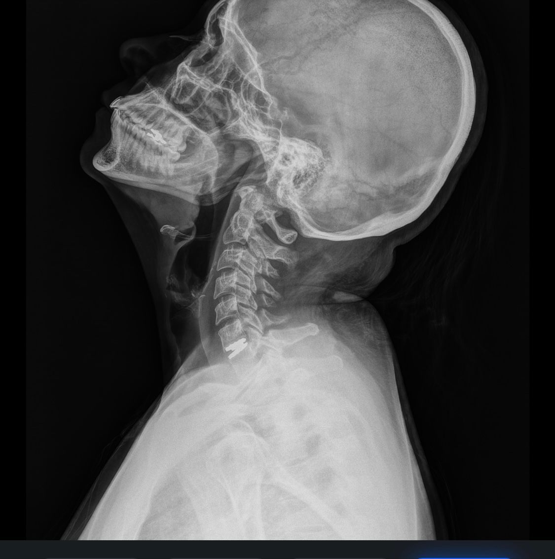 Oscar Enrique Ramírez Ramírez-2