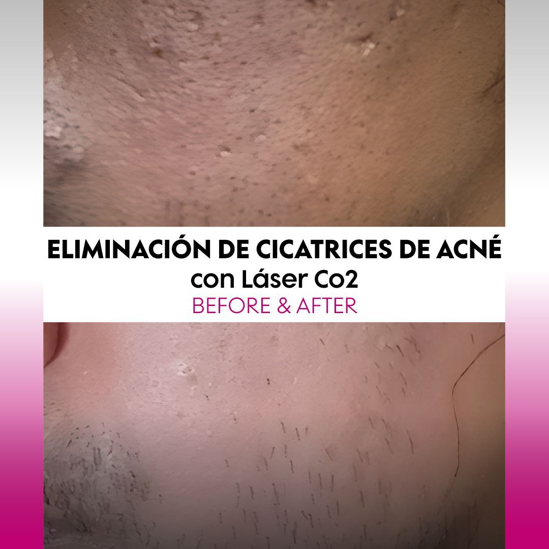 Alejandra Soriano Elorza-118