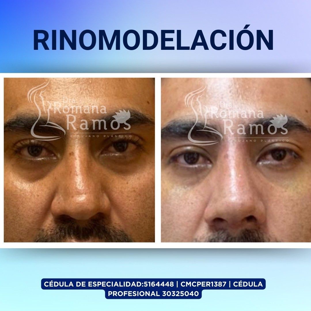 Romana Ramos Cárdenas-5