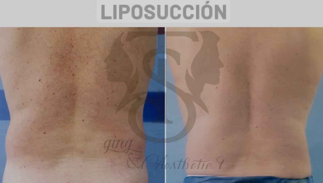 Samuel Torres Torres-17