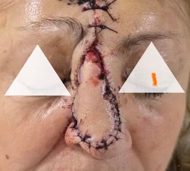 Luis  Cruz Benitez-1