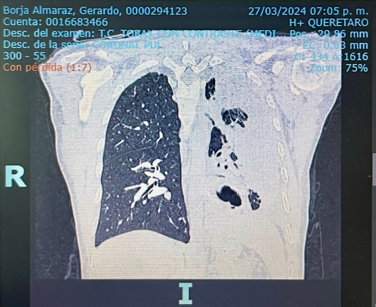 Rogelio Hernández García-94