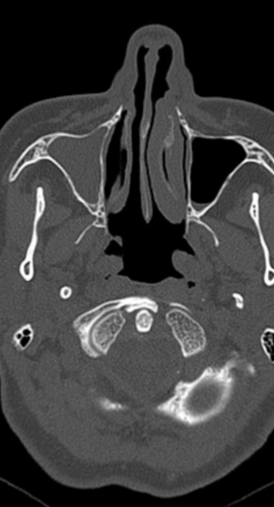 Rogelio Hernández García-67