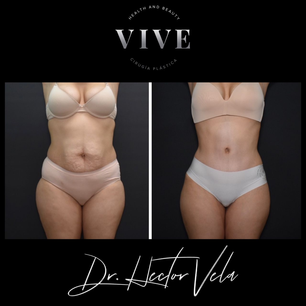 Héctor Eduardo Vela Cardona-93