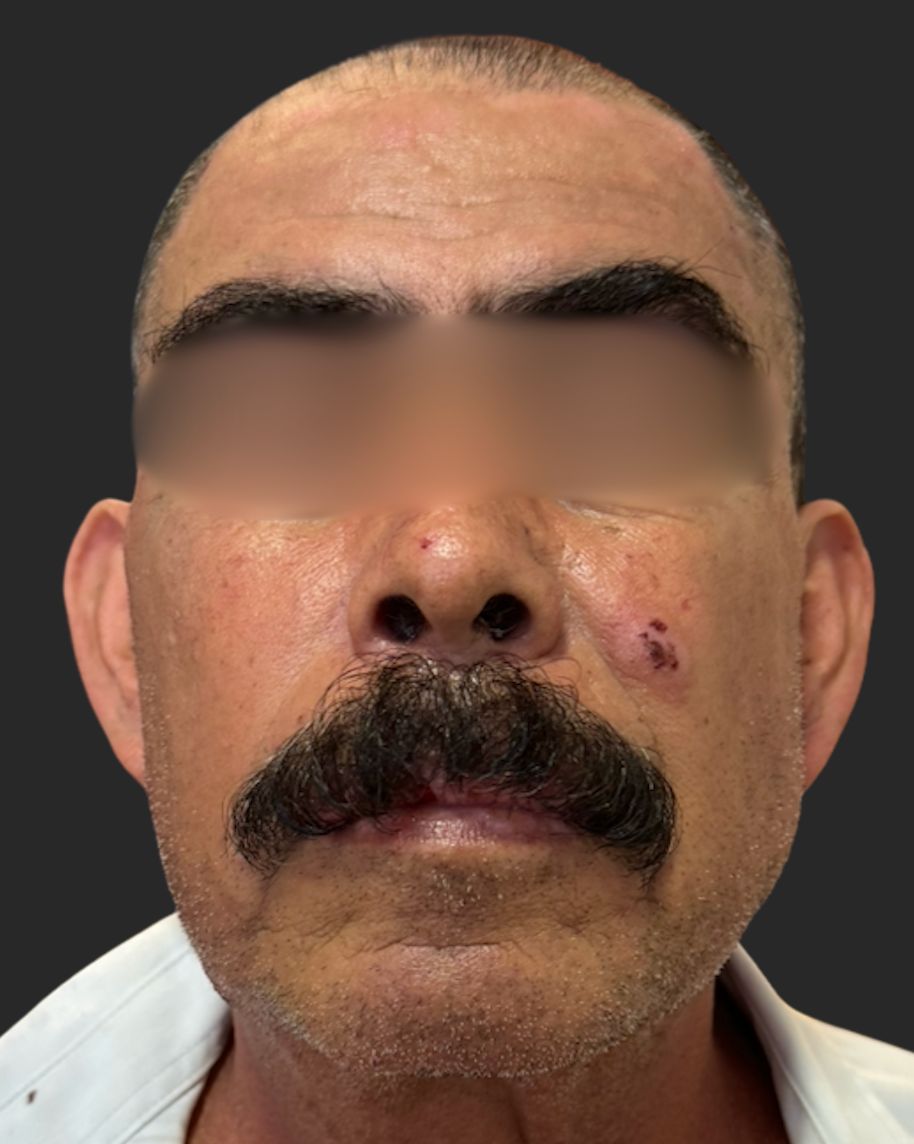 Lauro Francisco Varela Coronado-19