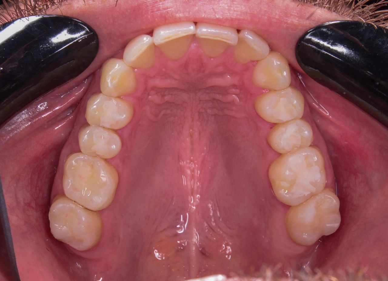 Anayansi Victoria Otero Guzmán-0