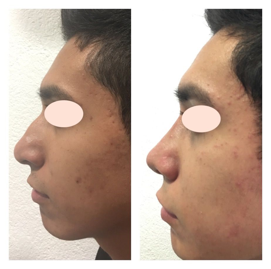 Carola Berenice Curiel Davalos-47