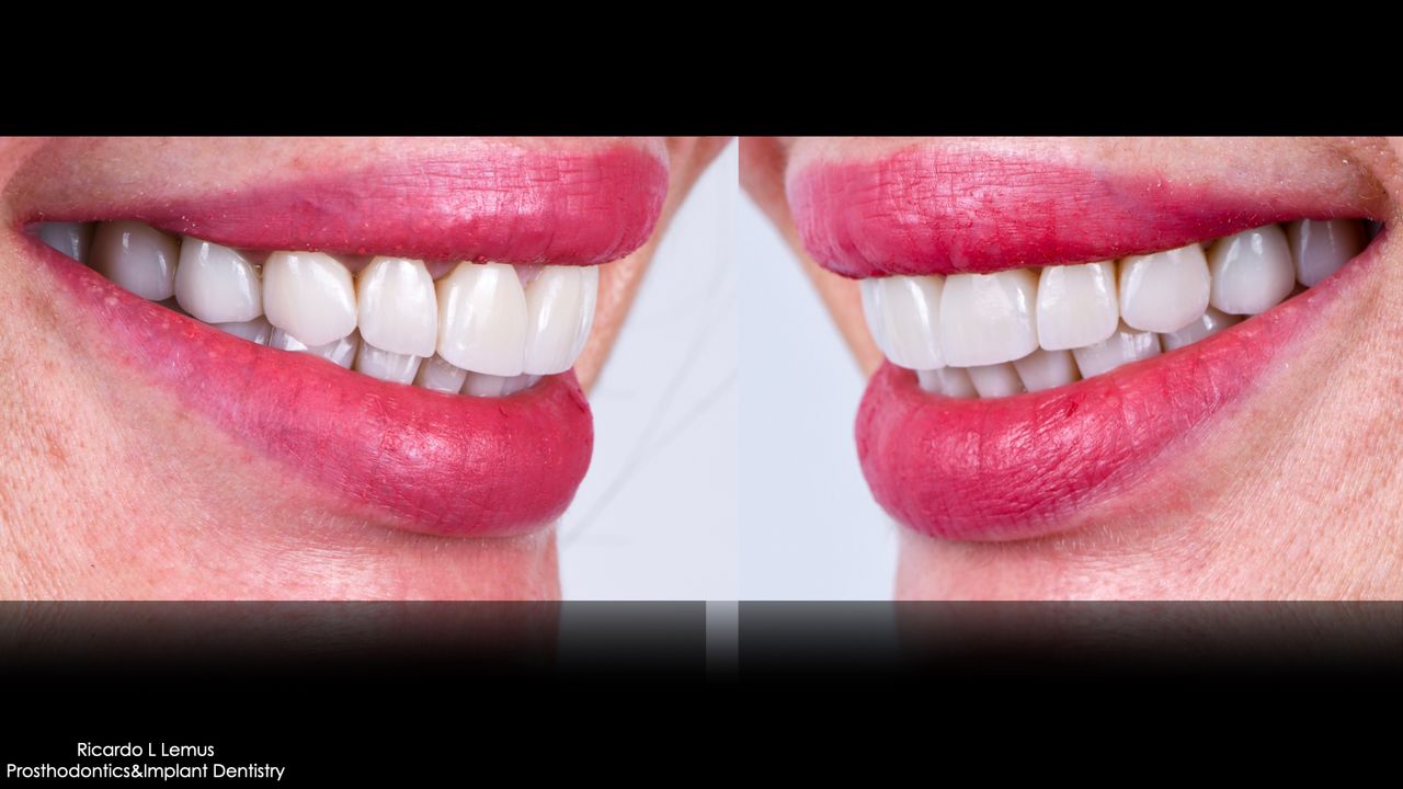 Ricardo López Lemus-11