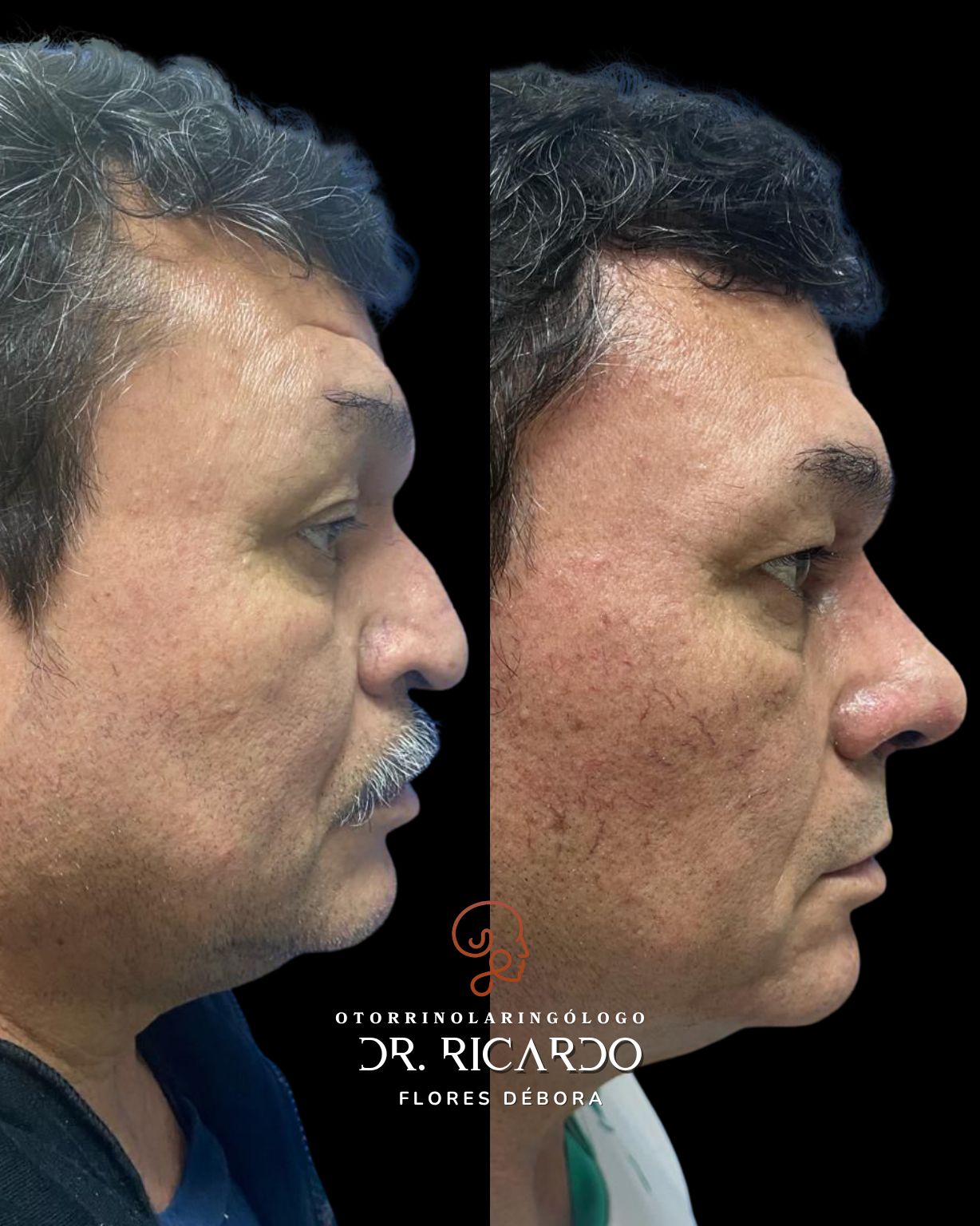 Ricardo Flores Débora-6