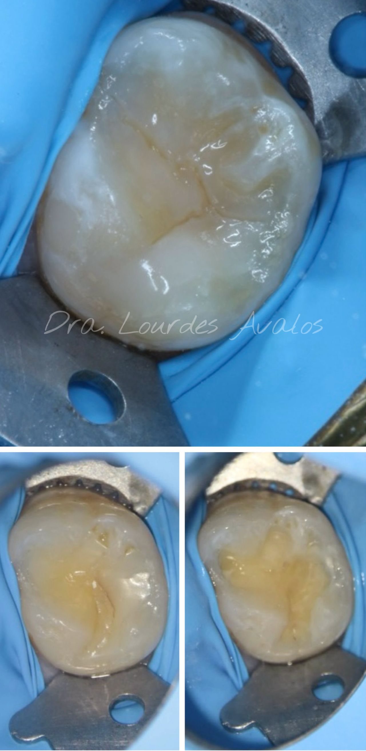 Lourdes Avalos Piña-4