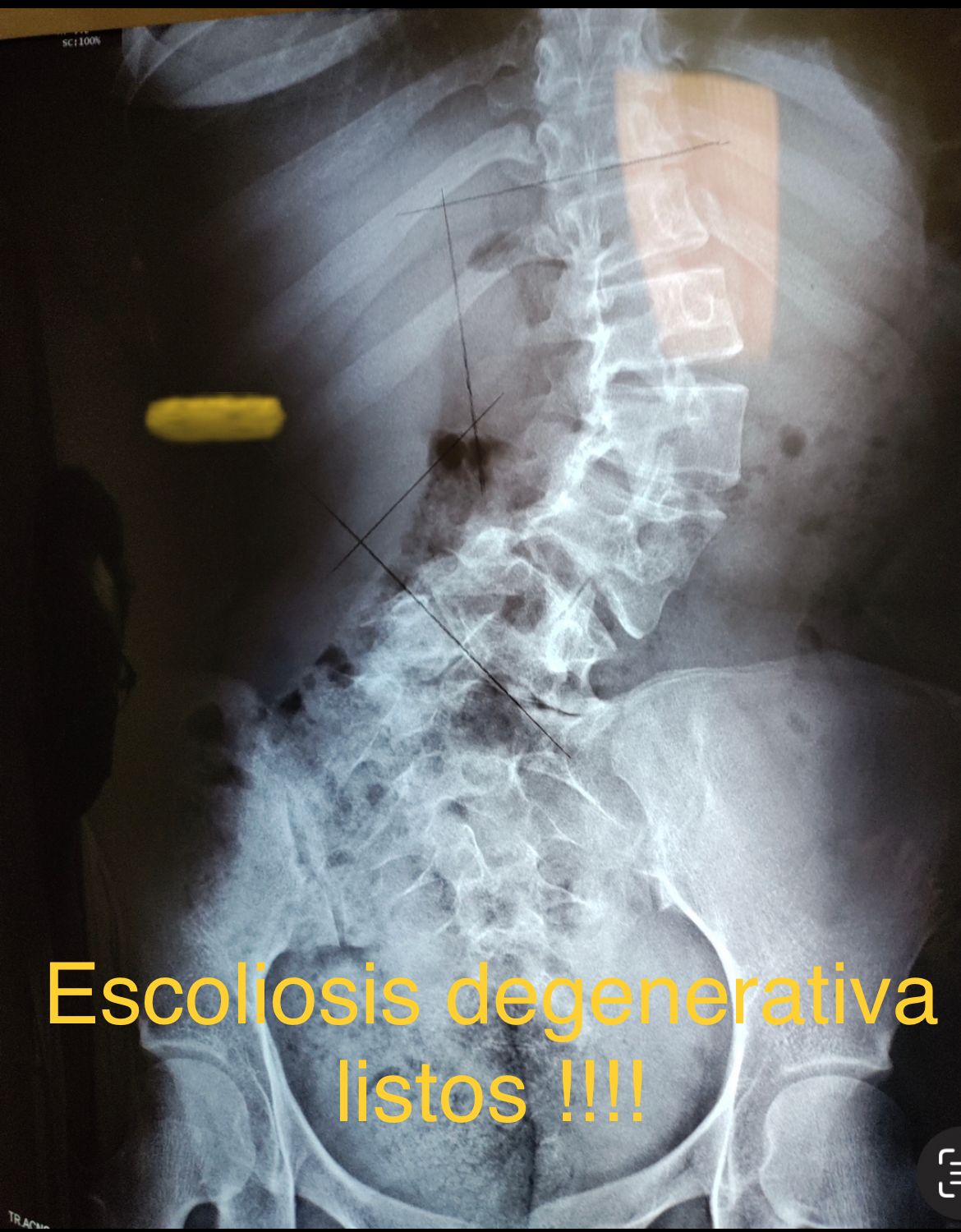 Emmanuel Bolaños Cortes-31