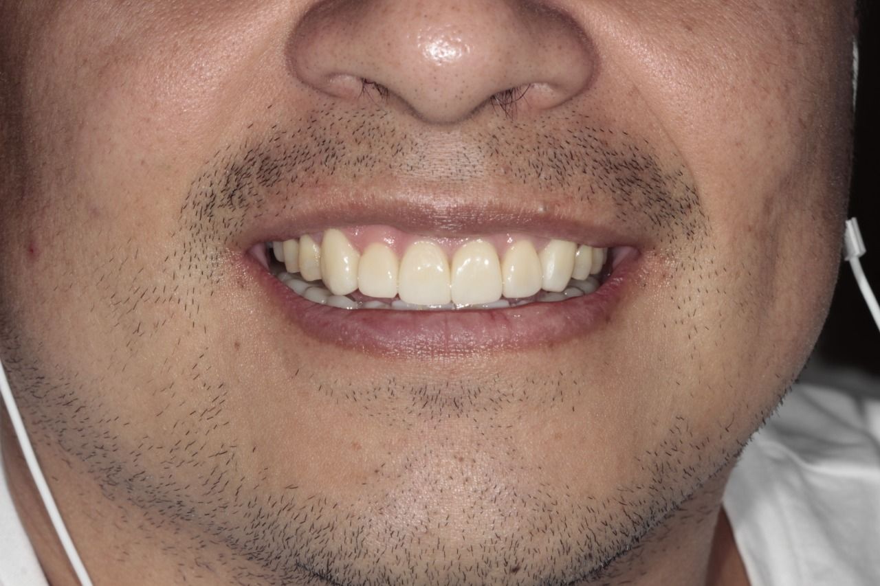 Mariel Itzayani Torres López-23