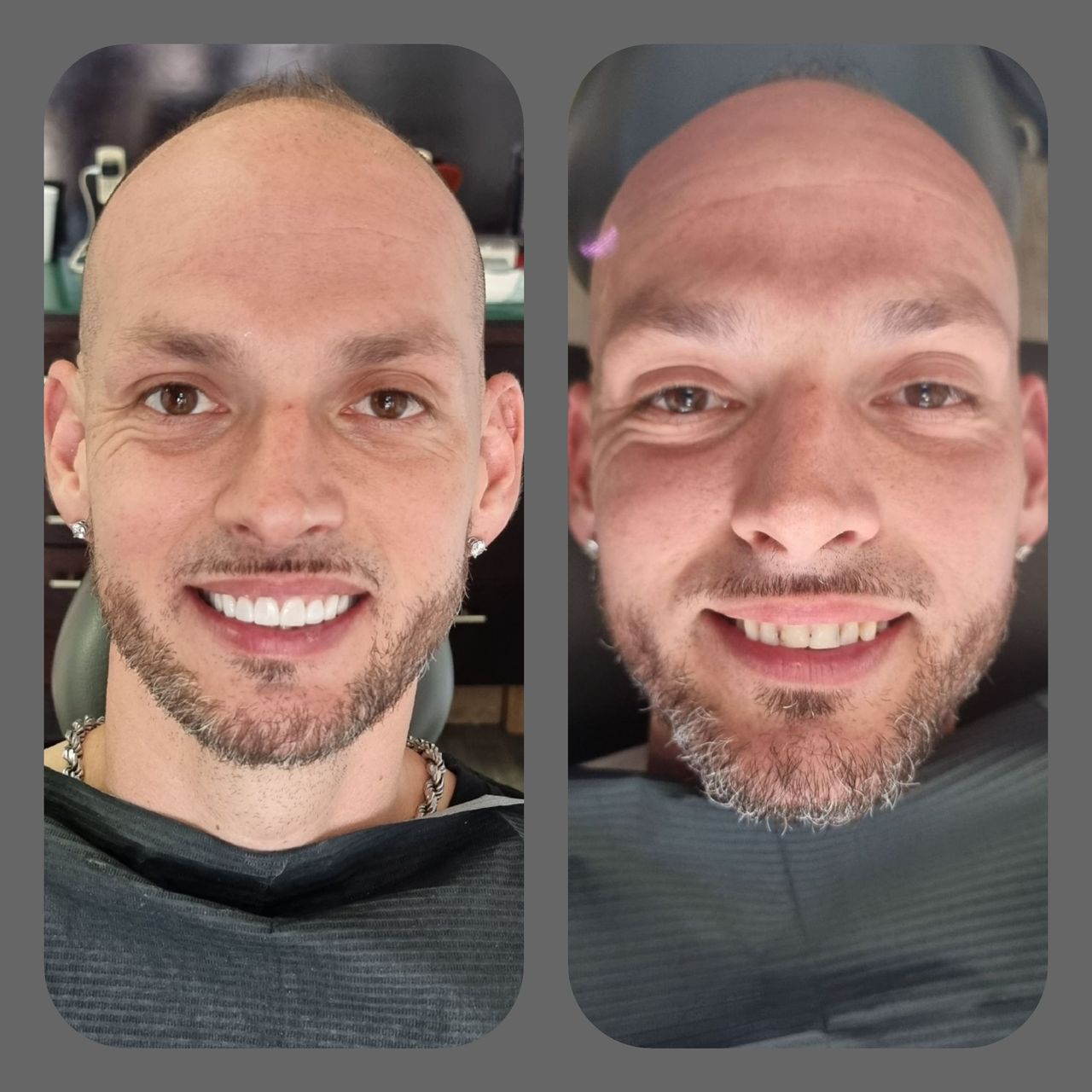 Alejandro Caballero P.-18