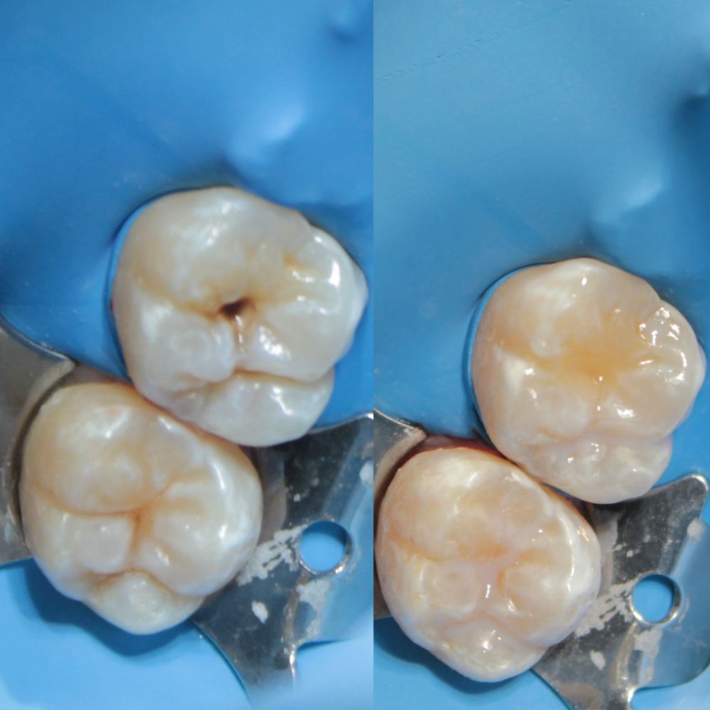 Itzel Abigail Montiel Garces-13