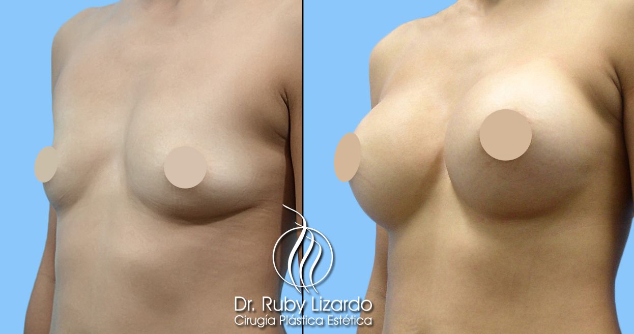 Ruby Lizardo Ramírez Robles-23