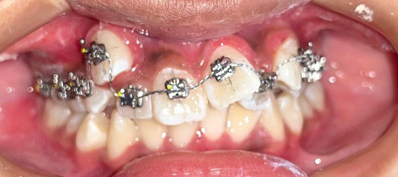 Zoe Guadalupe  Hernandez Aguilar-12