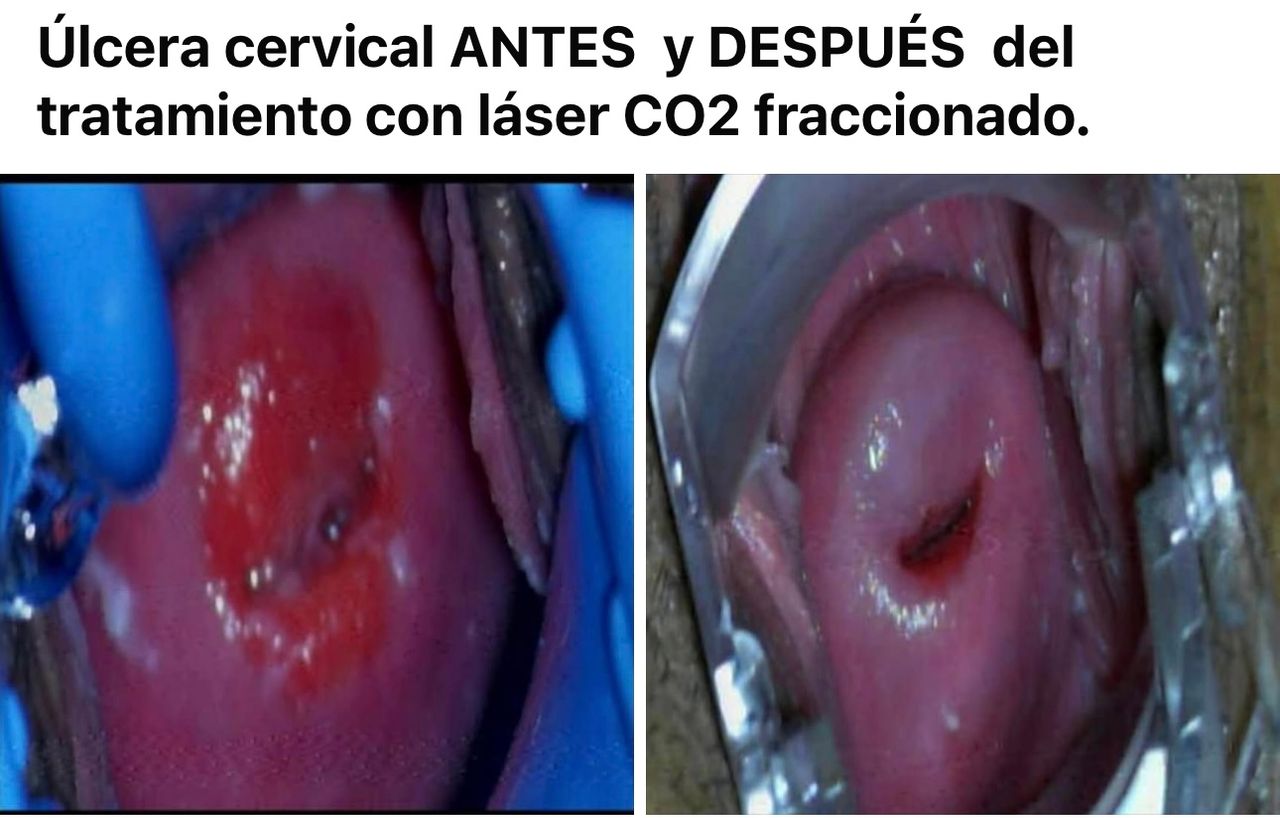 Francisco Carbajal-99