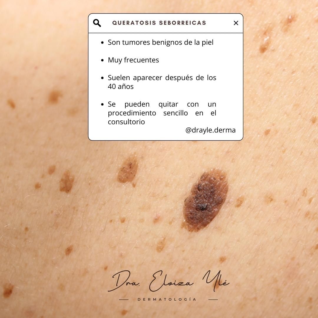 Eloiza Lizeth Ylé Arámburo-1