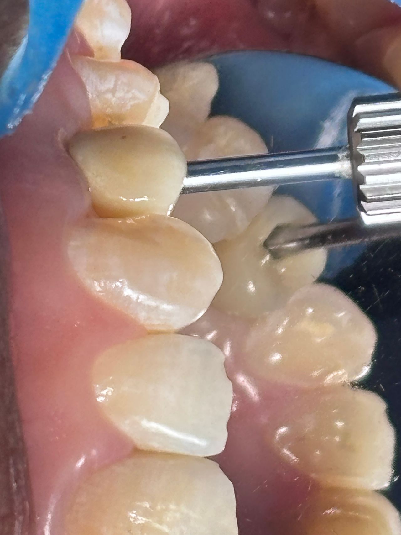 Juan Carlos Estrada Angeles-14