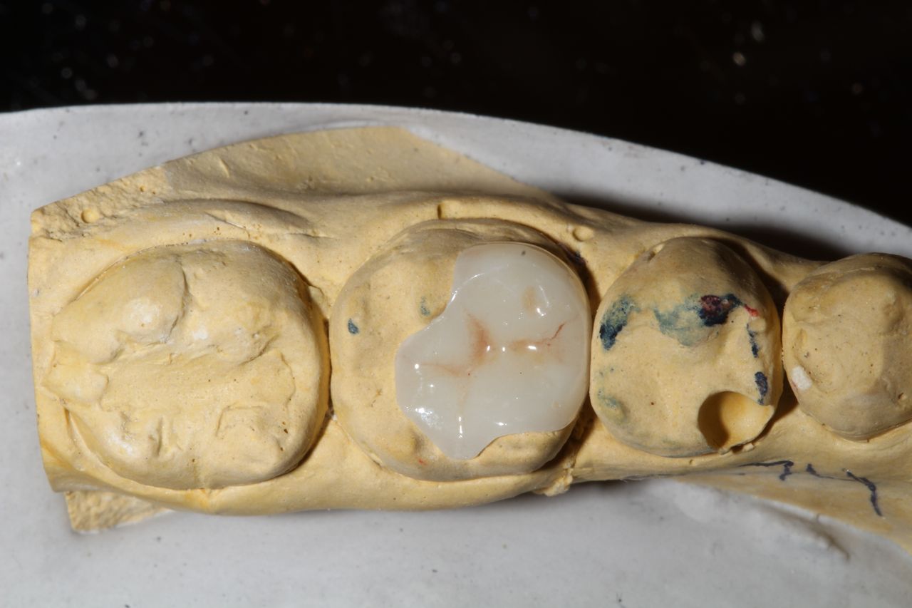 Hylse Najera Moya-27