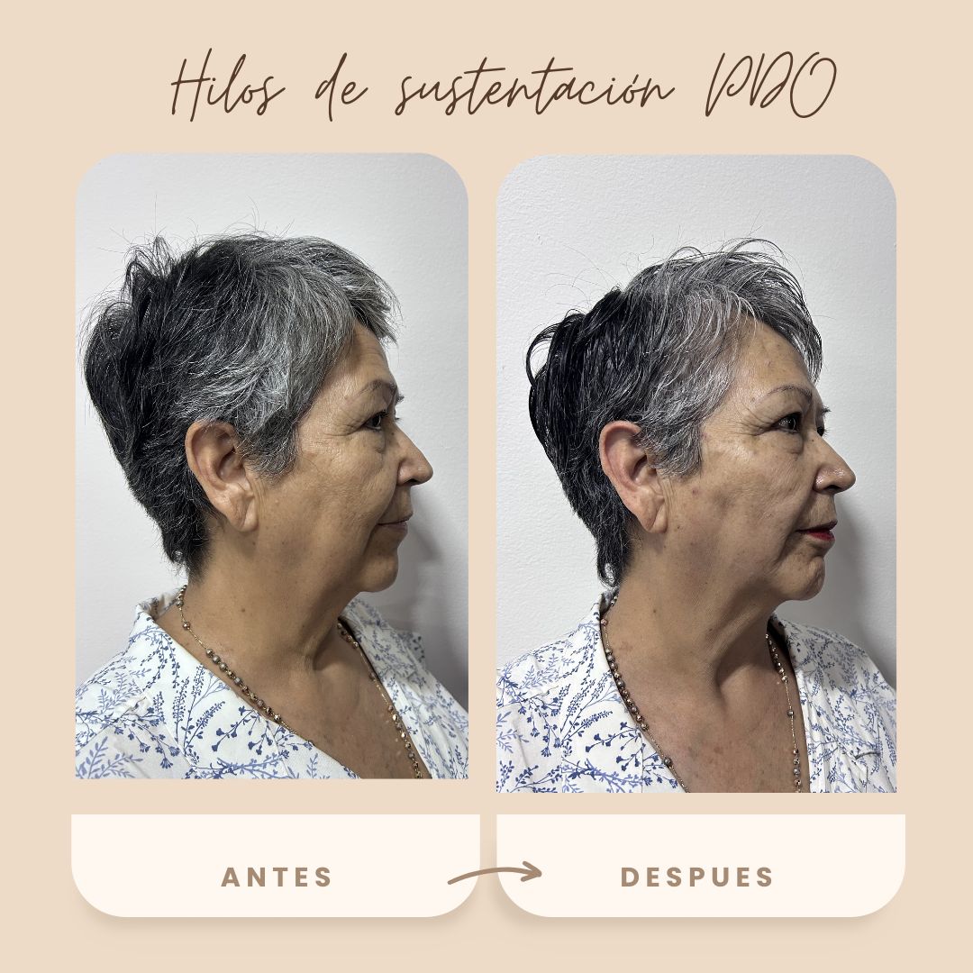 Sinue Hazael  Aguilar Hernández -6