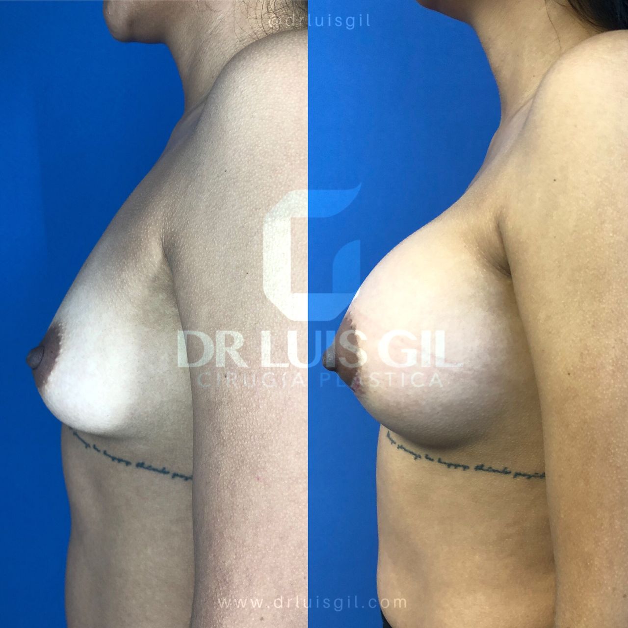 Luis Atilio Gil Pérez-21