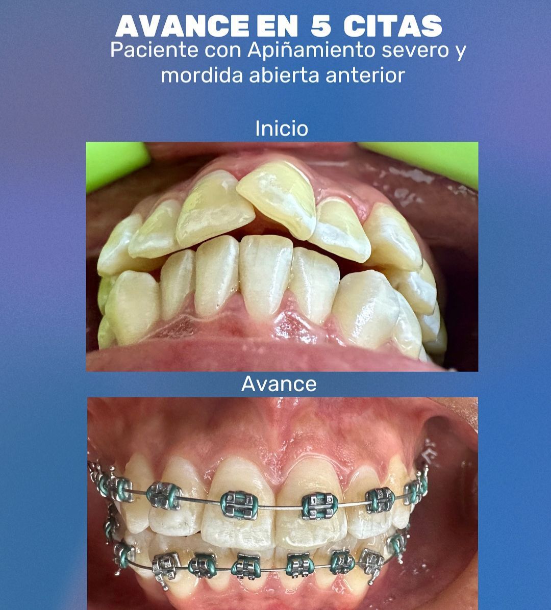 Valeria Valadez Osuna-8