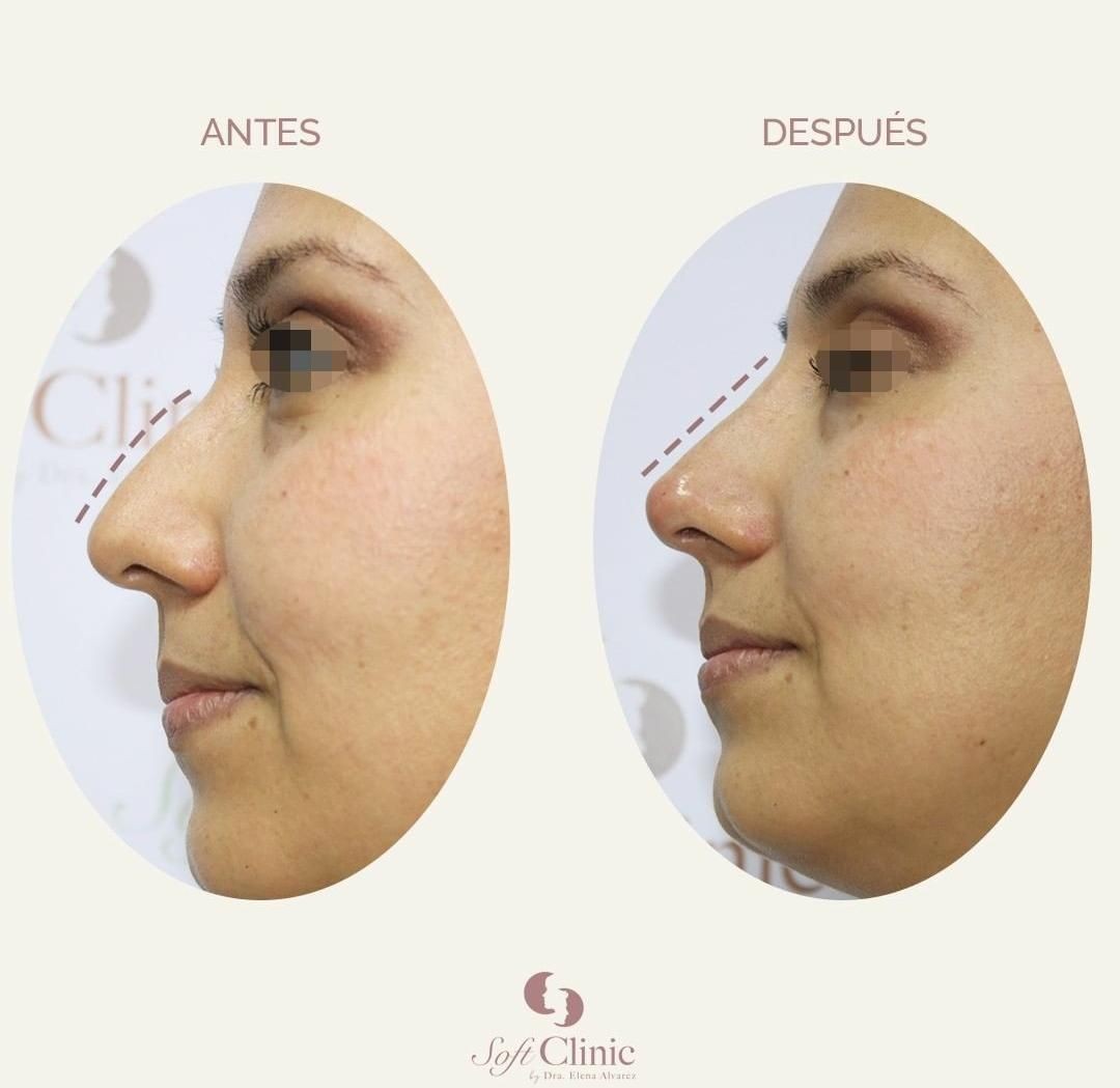 Elena Alvarez Velazquez-80