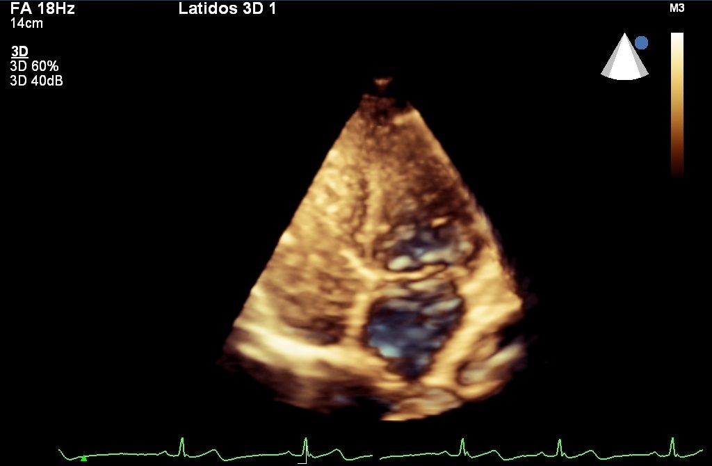 Heriberto Pruneda Ayala-13