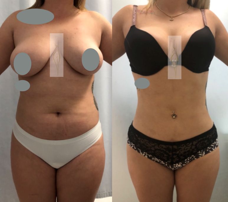 Rubén Nieto Balcázar-4