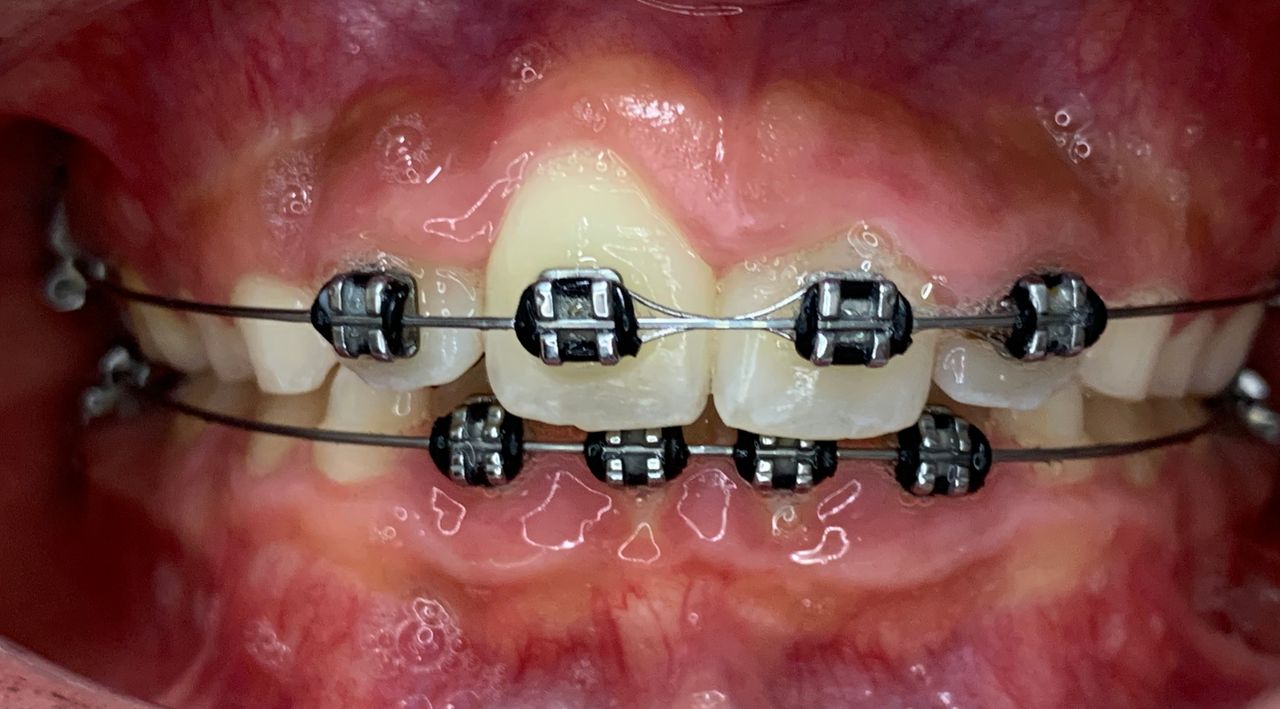 Patricia Rizo Palos-4