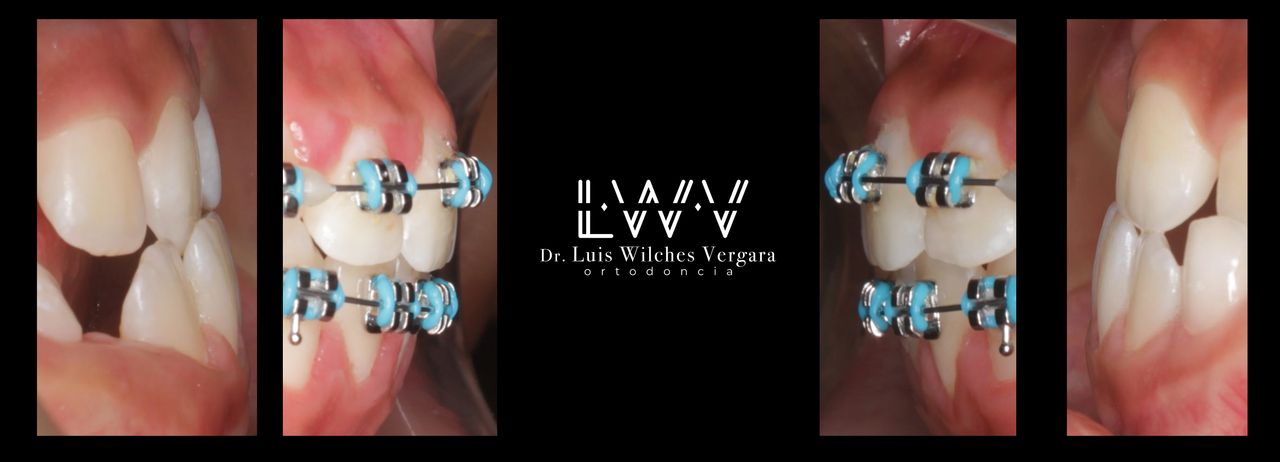 Luis Alberto Wilches Vergara-7