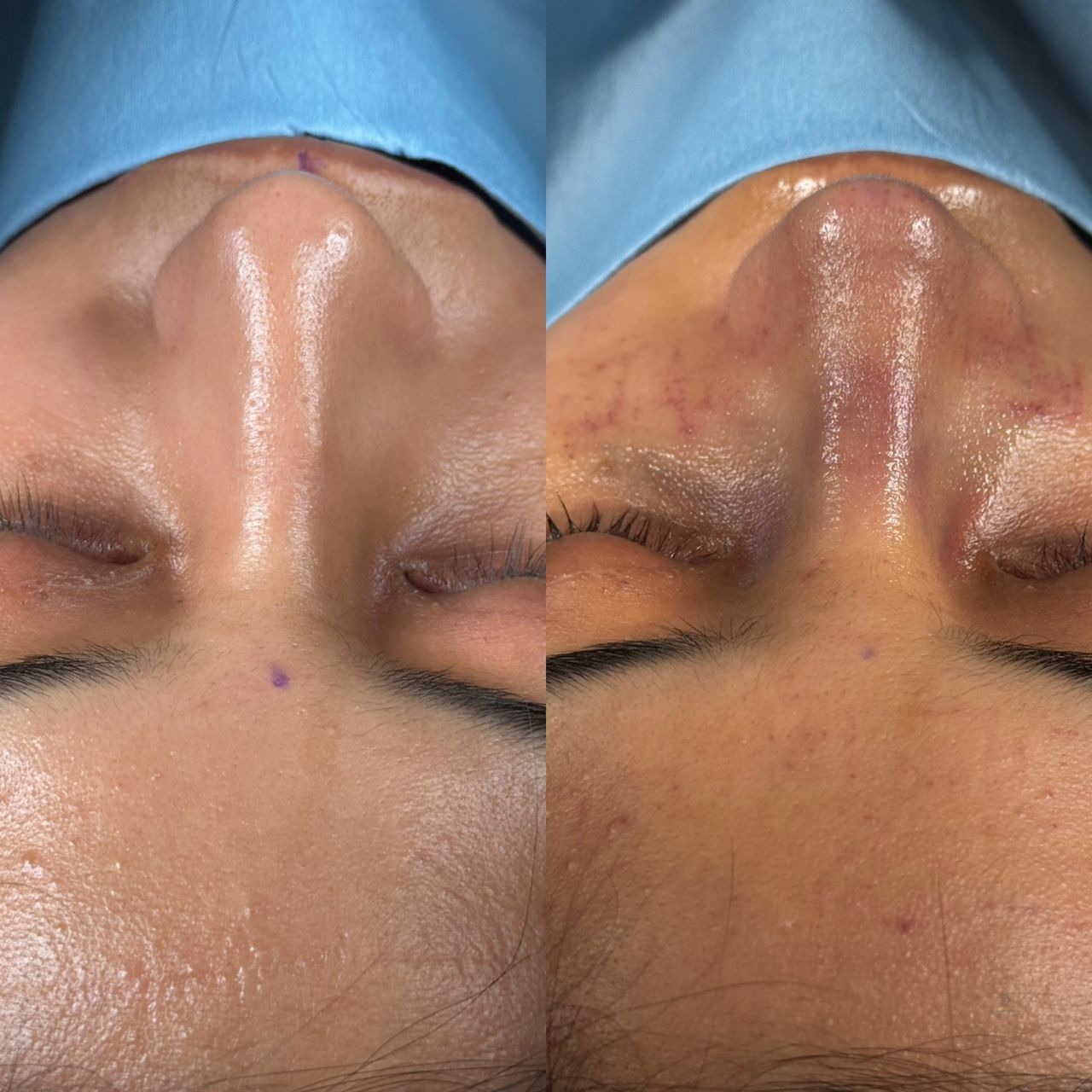 Angel Castro Urquizo-224